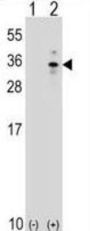 X-Box-Binding Protein 1 (XBP1) Antibody