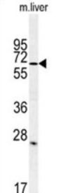 Leucine-Rich Repeat And Immunoglobulin-Like Domain-Containing Nogo Receptor-Interacting Protein 1 (LINGO-1) Antibody