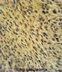 CCDC62 Antibody