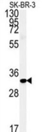 FAM92A1 Antibody