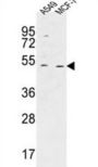 Chromosome 14 Open Reading Frame 94 (HAUS4) Antibody