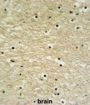 AP-5 Complex Subunit Zeta-1 (K0415) Antibody