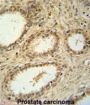 U5 Small Nuclear Ribonucleoprotein 40 kDa Protein (SNRNP40) Antibody