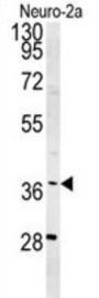 U5 Small Nuclear Ribonucleoprotein 40 kDa Protein (SNRNP40) Antibody