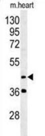 Myosin Regulatory Light Chain Interacting Protein (MYLIP) Antibody