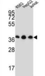 Heterogeneous Nuclear Ribonucleoprotein D-Like (HNRNPDL) Antibody