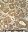 CRABP1 Antibody