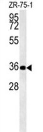Zinc Finger Protein DPF3 (DPF3) Antibody