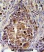 RDH16 Antibody