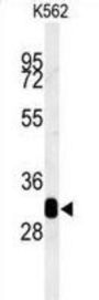 RDH16 Antibody