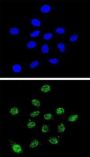 H/ACA Ribonucleoprotein Complex Subunit DKC1 (DKC1) Antibody