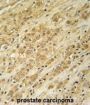 H/ACA Ribonucleoprotein Complex Subunit DKC1 (DKC1) Antibody