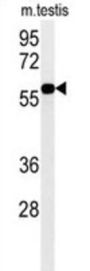 H/ACA Ribonucleoprotein Complex Subunit DKC1 (DKC1) Antibody