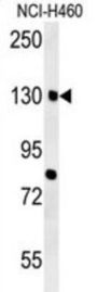 CTTB2 Antibody
