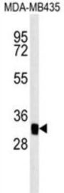 Mitochondrial Carrier 2 (MTCH2) Antibody