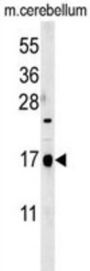 CA095 Antibody