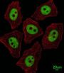 X-Ray Repair Cross Complementing 1 (XRCC1) Antibody