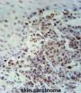 X-Ray Repair Cross Complementing 1 (XRCC1) Antibody