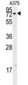 X-Ray Repair Cross Complementing 1 (XRCC1) Antibody