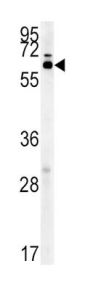 Zinc Finger Protein Aiolos (IKZF3) Antibody