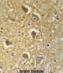 HAS2 Antibody