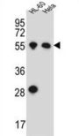 HAS2 Antibody