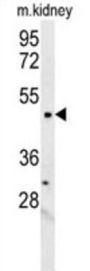 LCLT1 Antibody