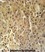 DHB13 Antibody