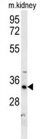 DHB13 Antibody