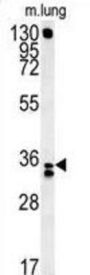 Reticulocalbin 3 (RCN3) Antibody