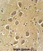 Aquaporin-11 (AQP11) Antibody