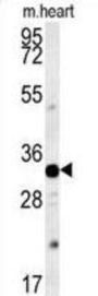 Aquaporin-11 (AQP11) Antibody