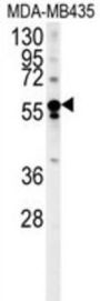 Rho Guanine Nucleotide Exchange Factor 3 (ARHGEF3) Antibody