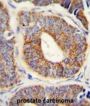 DnaJ (Hsp40) Homolog, Subfamily A, Member 1 (DNAJA1) Antibody