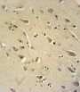 Rho-Related GTP-Binding Protein RhoQ (RHOQ) Antibody