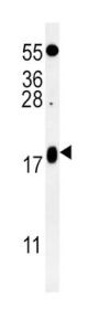 Vesicle-Associated Membrane Protein 4 (VAMP4) Antibody