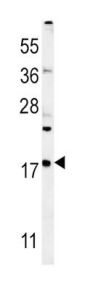 Vesicle-Associated Membrane Protein 4 (VAMP4) Antibody