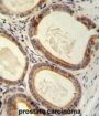 TRAM2 Antibody