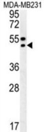 TRAM2 Antibody
