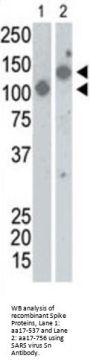 SARS virus Sn Antibody