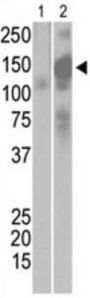 SARS virus Sm Antibody