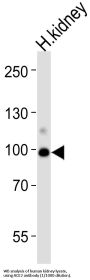 Angiotensin Converting Enzyme 2 (ACE2) Antibody