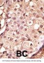 Angiotensin Converting Enzyme 2 (ACE2) Antibody