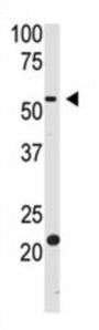 Beta-Site APP Cleaving Enzyme 2 (bACE2) Antibody