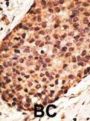 Matrix Metalloproteinase-16 (MMP16) Antibody