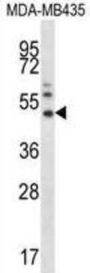 Matrix Metalloproteinase-16 (MMP16) Antibody