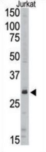 Sirtuin 5 (SIRT5) Antibody