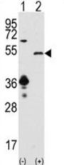 Sirtuin 7 (SIRT7) Antibody