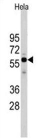 Cell Division Cycle 25A (Cdc25A) Antibody