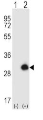 Growth Factor Receptor Bound Protein 2 (GRB2) Antibody